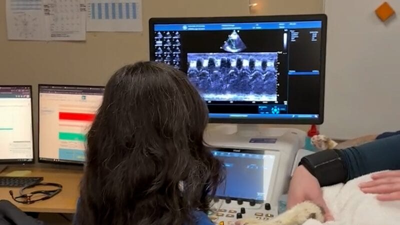 what-does-an-echocardiogram-show